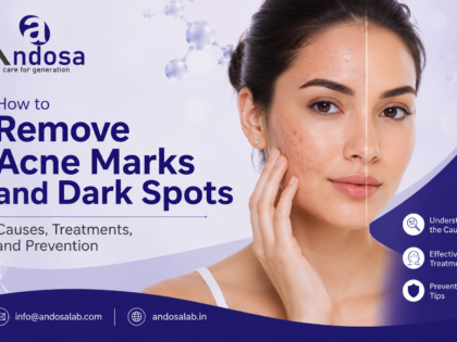 How to Remove Acne Marks and Dark Spots