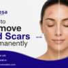 How to Remove Old Scars Permanently