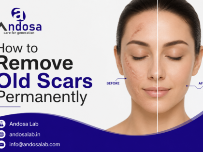 How to Remove Old Scars Permanently
