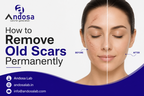 How to Remove Old Scars Permanently